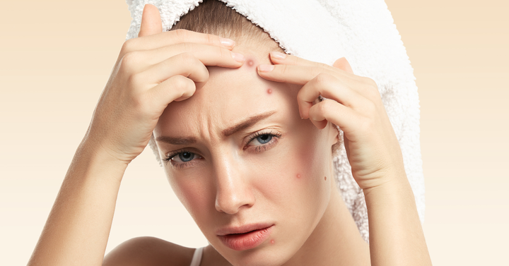 Dubai Humidity, Sweat & Pollution: Why Your Skin Breaks Out and How to Control Oily Skin Naturally