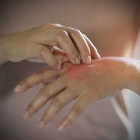 Picture for category Eczema Care